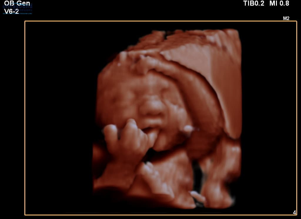 3D Scan at 29 Weeks - Look at Those Hands!