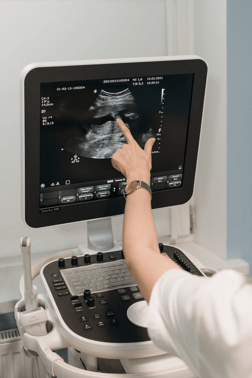 Fertility ultrasound scan at Ultrasound Ireland